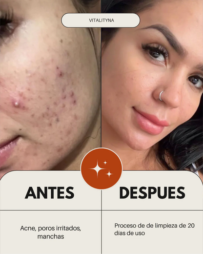 LUMIBUTIN™ – Tu piel, sin manchas, en 14 días.
