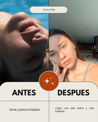 LUMIBUTIN™ – Tu piel, sin manchas, en 14 días.
